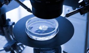 How to choose the low-cost IVF centre for infertility treatment?